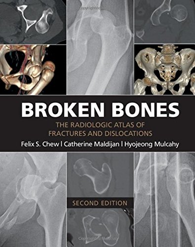 Broken Bones: The Radiologic Atlas of Fractures and Dislocations