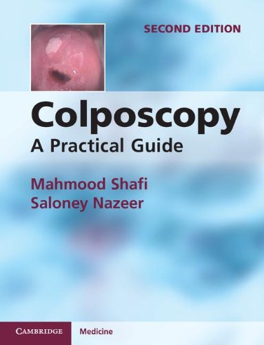 Colposcopy: A Practical Guide