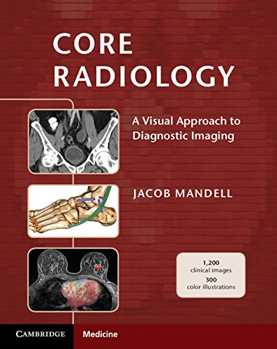 Book Cover Core Radiology: A Visual Approach to Diagnostic Imaging