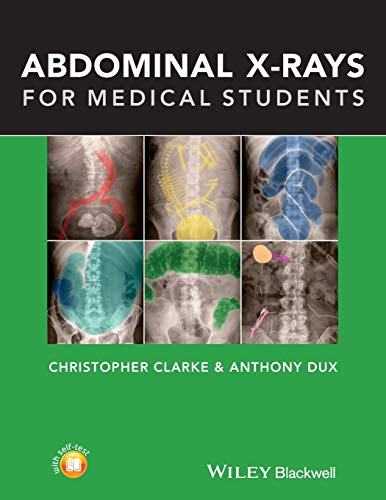 Book Cover Abdominal X-rays for Medical Students