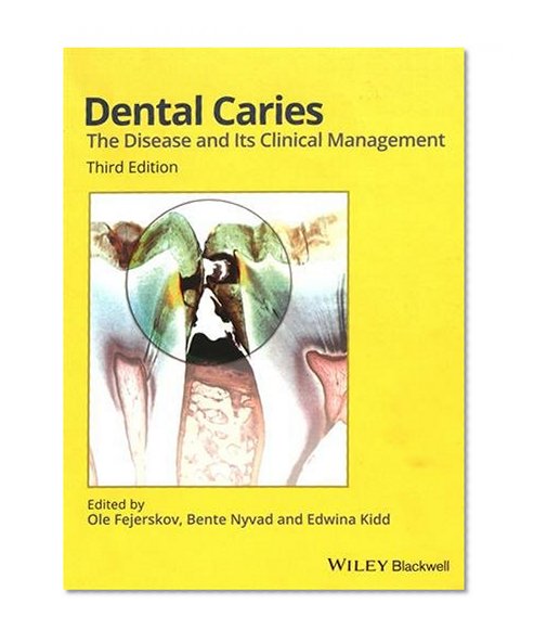 Book Cover Dental Caries: The Disease and its Clinical Management
