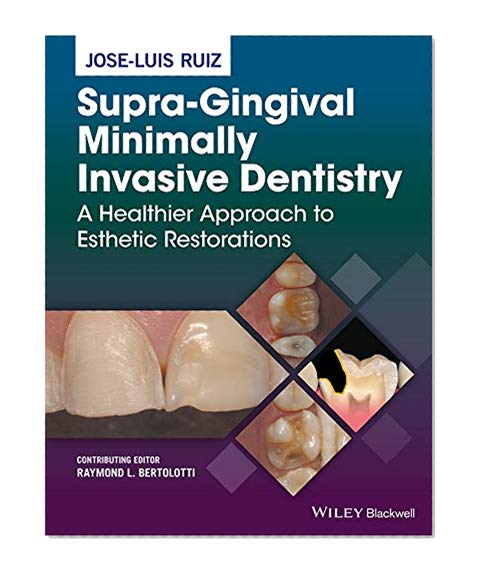 Supra-Gingival Minimally Invasive Dentistry: A Healthier Approach to Esthetic Restorations