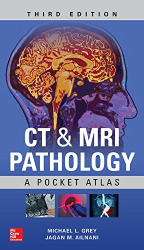 Book Cover CT & MRI Pathology: A Pocket Atlas, Third Edition