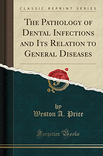 Book Cover The Pathology of Dental Infections and Its Relation to General Diseases (Classic Reprint)