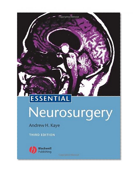 Book Cover Essential Neurosurgery