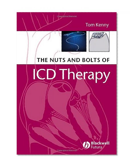 Book Cover The Nuts and Bolts of ICD Therapy