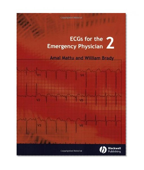Book Cover ECGs for the Emergency Physician 2