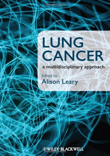 Book Cover Lung Cancer: A Multidisciplinary Approach