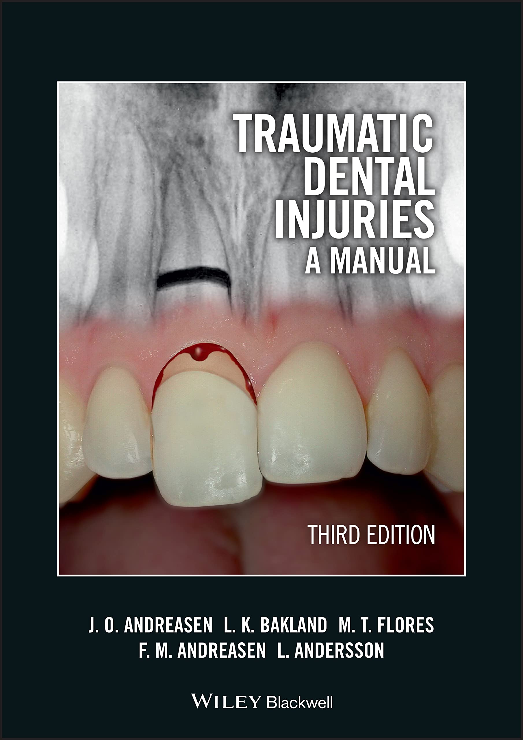 Book Cover Traumatic Dental Injuries: A Manual