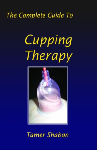 The Complete Guide To Cupping Therapy