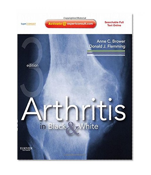 Book Cover Arthritis in Black and White: Expert Consult - Online and Print, 3e