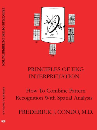 Principles Of EKG Interpretation