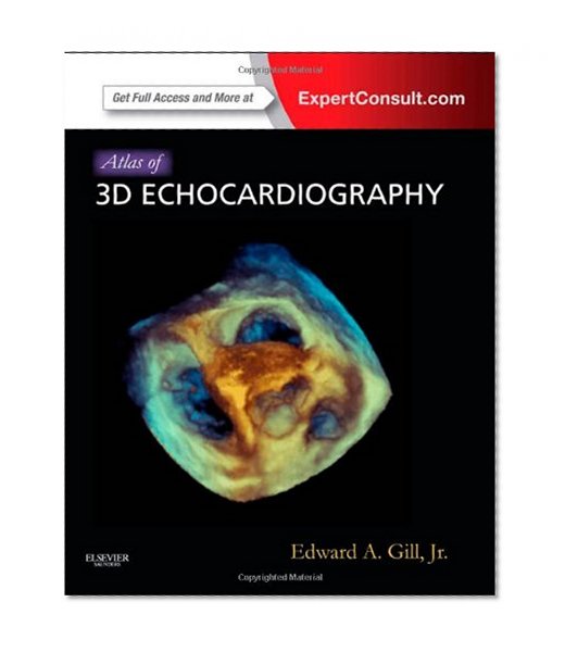 Atlas of 3D Echocardiography: Expert Consult - Online and Print, 1e