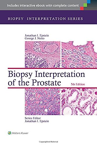 Book Cover Biopsy Interpretation of the Prostate (Biopsy Interpretation Series)