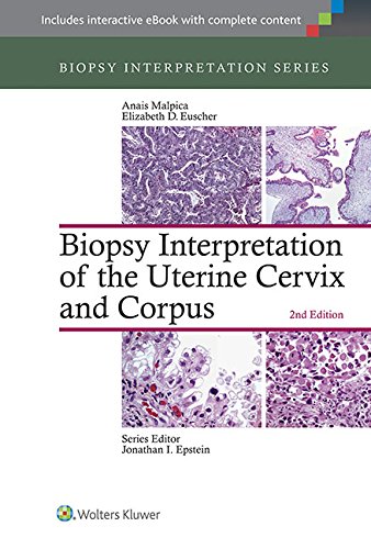 Book Cover Biopsy Interpretation of the Uterine Cervix and Corpus (Biopsy Interpretation Series)