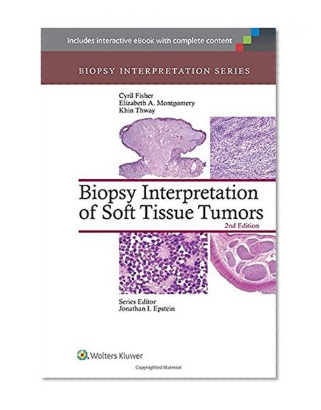 Book Cover Biopsy Interpretation of Soft Tissue Tumors (Biopsy Interpretation Series)