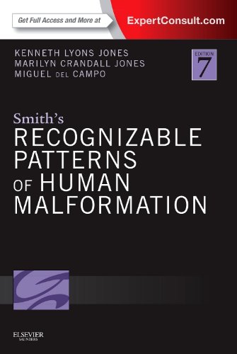 Book Cover Smith's Recognizable Patterns of Human Malformation: Expert Consult - Online and