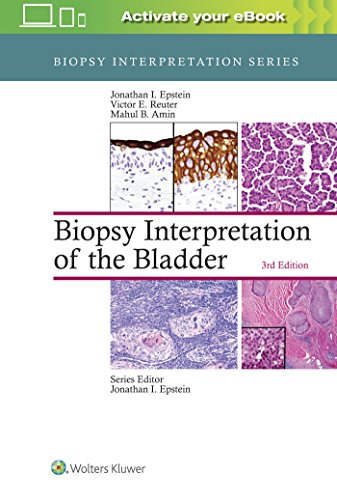 Book Cover Biopsy Interpretation of the Bladder (Biopsy Interpretation Series)