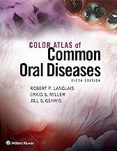 Book Cover Color Atlas of Common Oral Diseases
