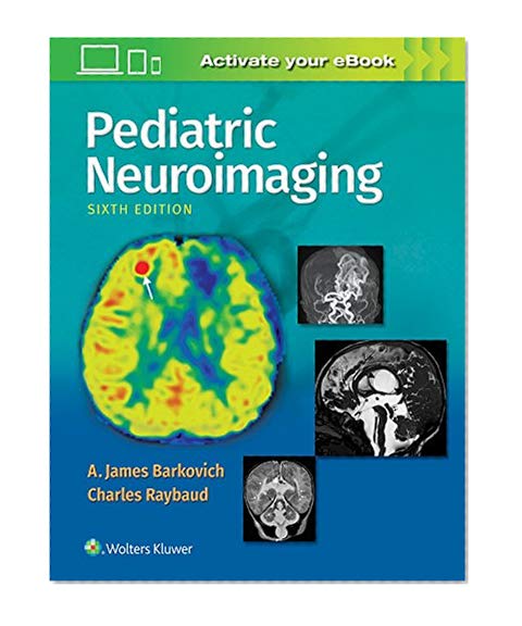 Book Cover Pediatric Neuroimaging