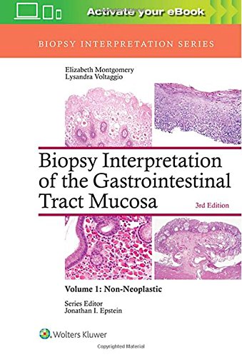 Book Cover Biopsy Interpretation of the Gastrointestinal Tract Mucosa: Volume 1: Non-Neoplastic