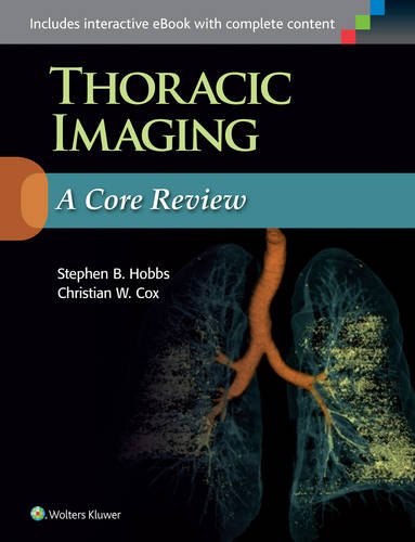 Book Cover Thoracic Imaging: A Core Review