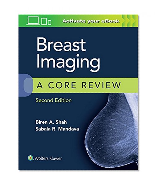 Book Cover Breast Imaging: A Core Review