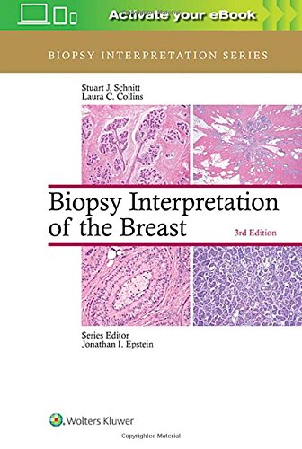 Book Cover Biopsy Interpretation of the Breast (Biopsy Interpretation Series)