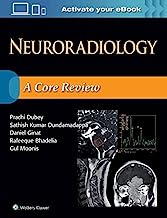 Book Cover Neuroradiology: A Core Review