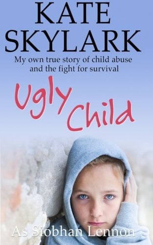 Book Cover Ugly Child: My Own True Story of Child Abuse and the Fight for Survival (Skylark Child Abuse True Stories) (Volume 3)
