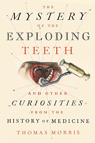 Book Cover The Mystery of the Exploding Teeth: And Other Curiosities from the History of Medicine
