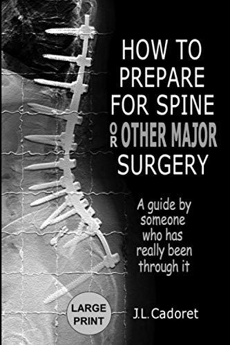 Book Cover HOW TO PREPARE FOR SPINE or OTHER MAJOR SURGERY: A guide by someone who has really been through it