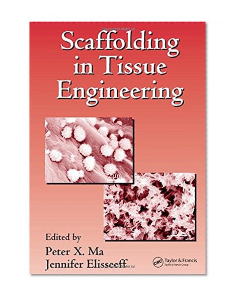 Scaffolding In Tissue Engineering