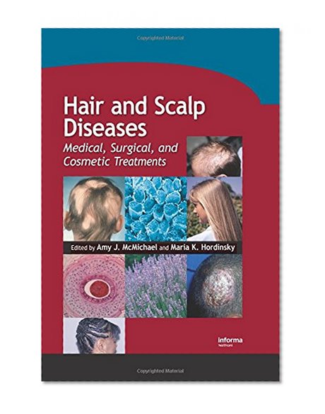 Hair and Scalp Diseases: Medical, Surgical, and Cosmetic Treatments (Basic and Clinical Dermatology)
