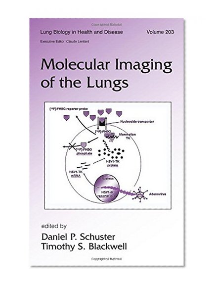 Molecular Imaging of the Lungs (Lung Biology in Health and Disease)