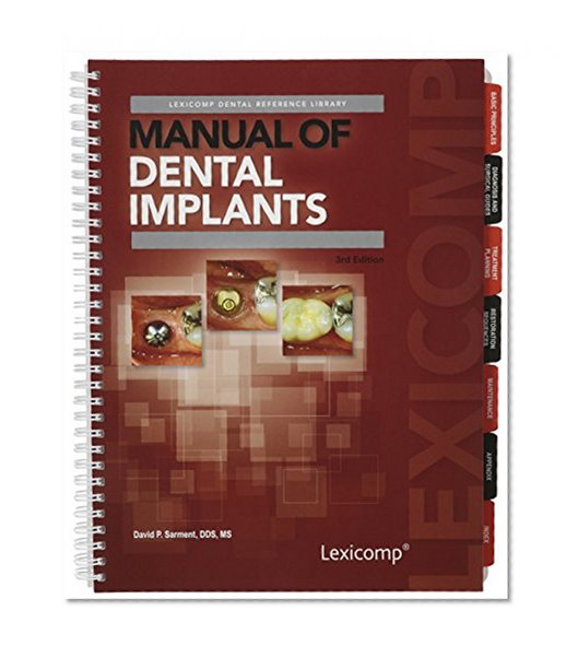 Book Cover Manual of Dental Implants