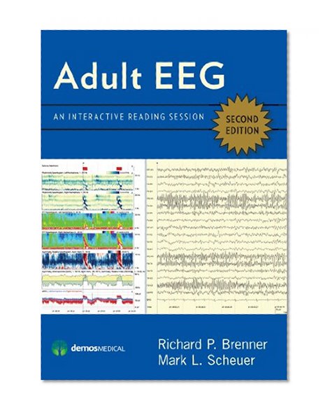 Book Cover Adult EEG, Second Edition DVD: An Interactive Reading Session