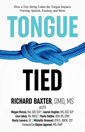 Book Cover Tongue-Tied: How a Tiny String Under the Tongue Impacts Nursing, Speech, Feeding, and More