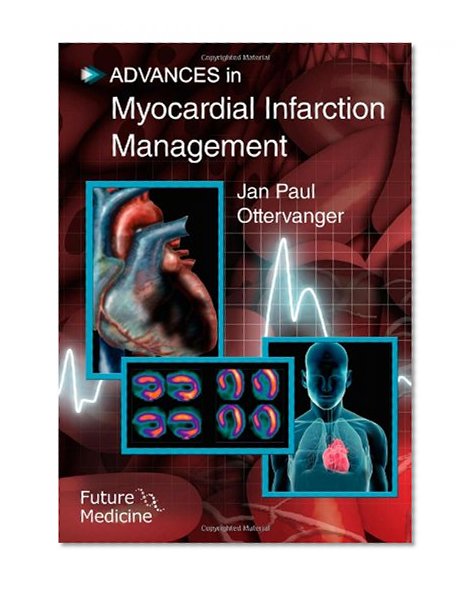 Advances in Myocardial Infarction Management