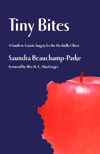 Tiny Bites: A Guide to Gastric Surgery for the Morbidly Obese