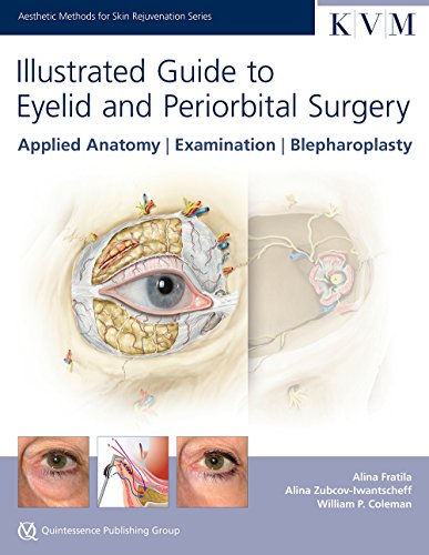 Illustrated Guide to Eyelid & Periorbital Surgery: Applied Anatomy, Examination, Blepharoplasty (Aesthetic Methods for Skin Rejuvenation Series)