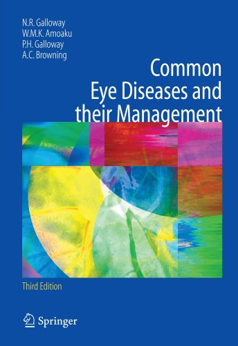 Common Eye Diseases and their Management (Common Eye Diseases and Their Management (Galloway))