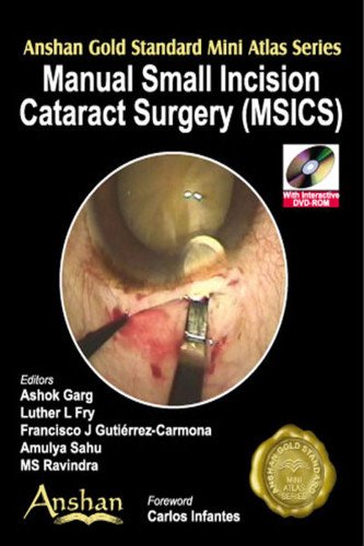 Mini Atlas of Surgical Incisions in Cataract Surgery (Anshan Gold Standard Mini Atlas) (Anshan Gold Standard Mini Atlas)
