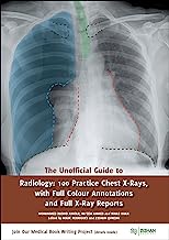 The Unofficial Guide to Radiology: 100 Practice Chest X Rays with Full Colour Annotations and Full X Ray Reports (Unofficial Guides to Medicine)