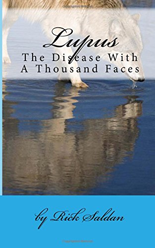 Book Cover Lupus, the Disease With a Thousand Faces: Why This Dreadful Disease Continually Goes Undetected and Untreated by the Medical Community