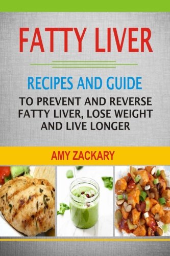 Book Cover Fatty Liver: Recipes And Guide To Prevent And Reverse Fatty Liver, Lose Weight And Live Longer
