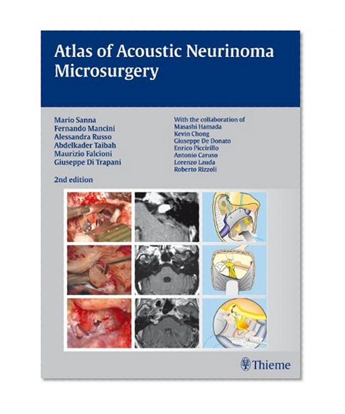 Atlas of Acoustic Neurinoma Microsurgery