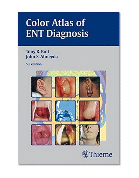 Book Cover Color Atlas of ENT Diagnosis