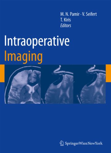 Intraoperative Imaging (Acta Neurochirurgica Supplement, 109)