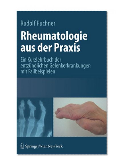 Rheumatologie aus der Praxis: Kurzlehrbuch der entzÃ¼ndlichen Gelenkerkrankungen mit Fallbeispielen (German Edition)